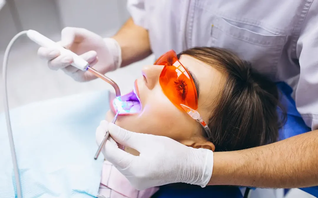 ¿El blanqueamiento dental daña los dientes? Mitos y verdades
